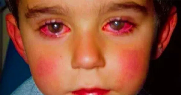 THIS LITTLE BOY LOST HIS SIGHT BECAUSE OF THIS TOY THAT YOU PROBABLY HAVE AT HOME